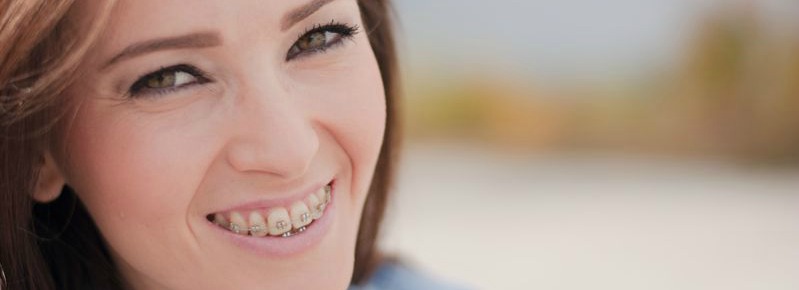 Clinica Dental Mediterrani | ¿Cómo limpiar tus dientes cuando llevas bráckets?